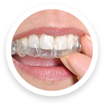 Invisalign Orthodontist Duchesne Herriman UT Icon