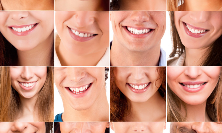 Collage Of Different Smiles