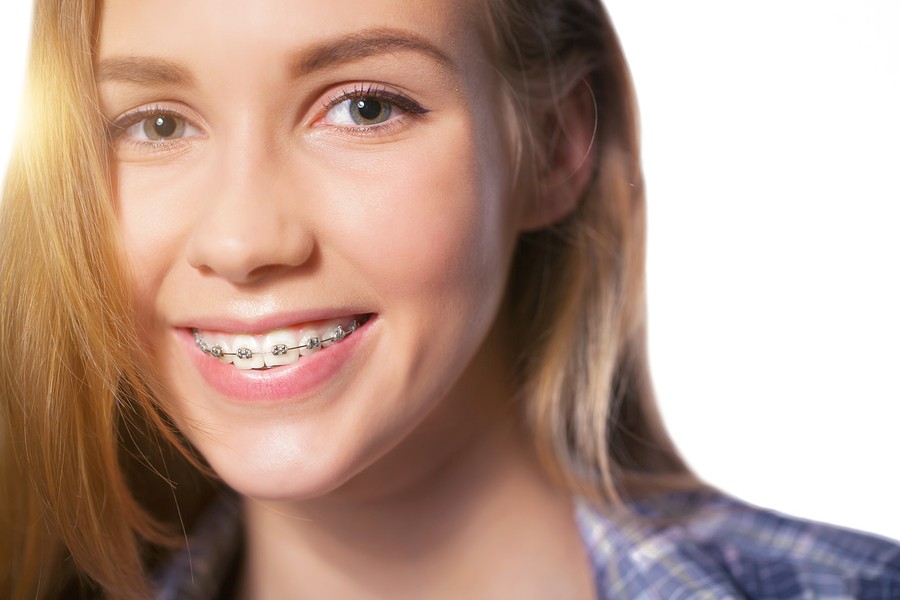 Get Braces in West Jordan from Our 5-Star-Rated Orthodontist