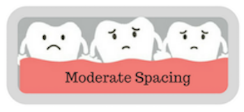 moderate-spacing-quiz