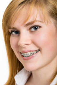 west jordan orthodontics